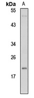 POD-1 Rabbit Polyclonal Antibody