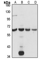 TCTE1 Rabbit Polyclonal Antibody