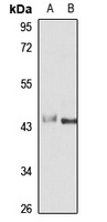 TDP2 Rabbit Polyclonal Antibody