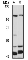 TGN38 Rabbit Polyclonal Antibody
