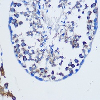 TGN38 Rabbit Polyclonal Antibody