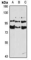 THOC5 Rabbit Polyclonal Antibody