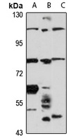 TIM4 Rabbit Polyclonal Antibody