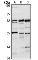 TKTL1 Rabbit Polyclonal Antibody