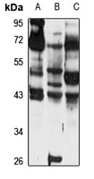 TMEFF2 Rabbit Polyclonal Antibody