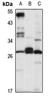 CD263 Rabbit Polyclonal Antibody