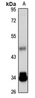 TNIP2 Rabbit Polyclonal Antibody