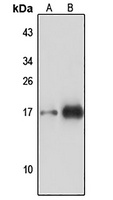 TOM22 Rabbit Polyclonal Antibody