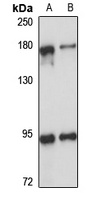 53BP2 Rabbit Polyclonal Antibody