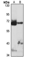 TRIM26 Rabbit Polyclonal Antibody