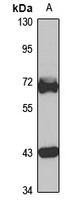 TRIM29 Rabbit Polyclonal Antibody