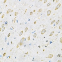TRIM29 Rabbit Polyclonal Antibody