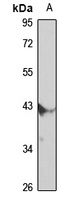 TRIM63 Rabbit Polyclonal Antibody