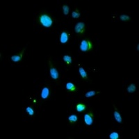TRIM63 Rabbit Polyclonal Antibody