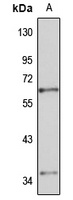 TRMT6 Rabbit Polyclonal Antibody