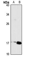 TSLP Rabbit Polyclonal Antibody
