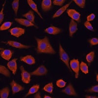 TSLP Rabbit Polyclonal Antibody