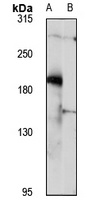 TTC3 Rabbit Polyclonal Antibody