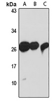TXNDC9 Rabbit Polyclonal Antibody