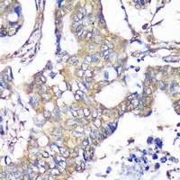 TXNDC9 Rabbit Polyclonal Antibody