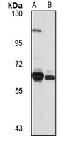 TXNRD1 Rabbit Polyclonal Antibody