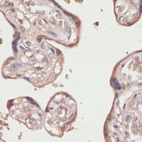 TXNRD1 Rabbit Polyclonal Antibody