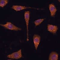 TXNRD1 Rabbit Polyclonal Antibody