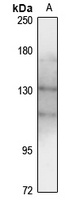 TYK2 Rabbit Polyclonal Antibody