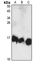 UBE2D3 Rabbit Polyclonal Antibody