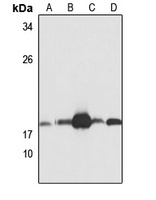 UBE2L6 Rabbit Polyclonal Antibody