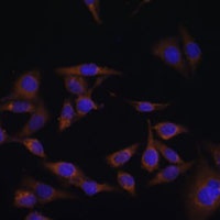 UBE2L6 Rabbit Polyclonal Antibody