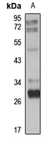 ULBP1 Rabbit Polyclonal Antibody