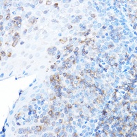 ULBP1 Rabbit Polyclonal Antibody