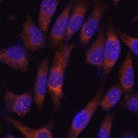 Munc13-2 Rabbit Polyclonal Antibody