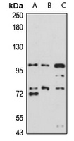UNC5B Rabbit Polyclonal Antibody