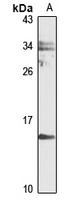 UXT Rabbit Polyclonal Antibody