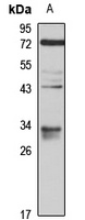 VDAC3 Rabbit Polyclonal Antibody