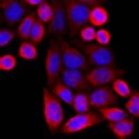 VDAC3 Rabbit Polyclonal Antibody