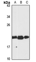 VPS25 Rabbit Polyclonal Antibody