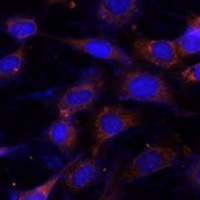VPS25 Rabbit Polyclonal Antibody