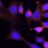 VPS26A Rabbit Polyclonal Antibody