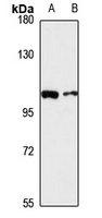 VPS39 Rabbit Polyclonal Antibody
