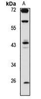 WNT10B Rabbit Polyclonal Antibody