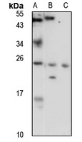 ZNRF1 Rabbit Polyclonal Antibody