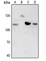 Beta Amyloid Rabbit Polyclonal Antibody