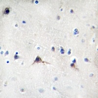 Beta Amyloid Rabbit Polyclonal Antibody