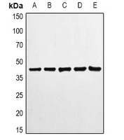 Beta-actin Rabbit Monoclonal Antibody