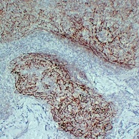 CD21 Mouse Monoclonal Antibody