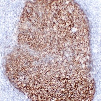 CD21 Mouse Monoclonal Antibody