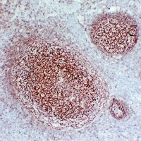 CD21 Mouse Monoclonal Antibody